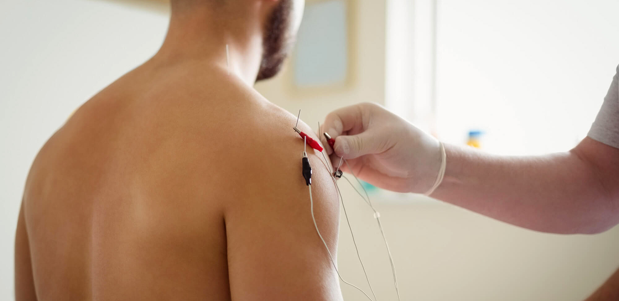 Σεμινάρια Dry Needling για φυσικοθεραπευτές σε Αθήνα, Θεσσαλονίκη, Κρήτη και Λευκωσία Κύπρου